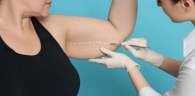Rekonwalescencja po liposukcji co warto wiedzieć po zabiegu?